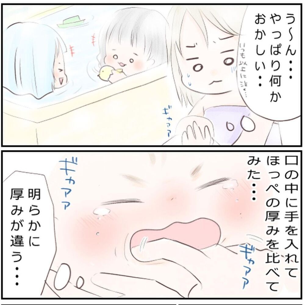 やっぱり息子の様子がおかしい！ 夜間の相談窓口に連絡することに【生後3ヶ月の息子が小児顔面麻痺に Vol.8】