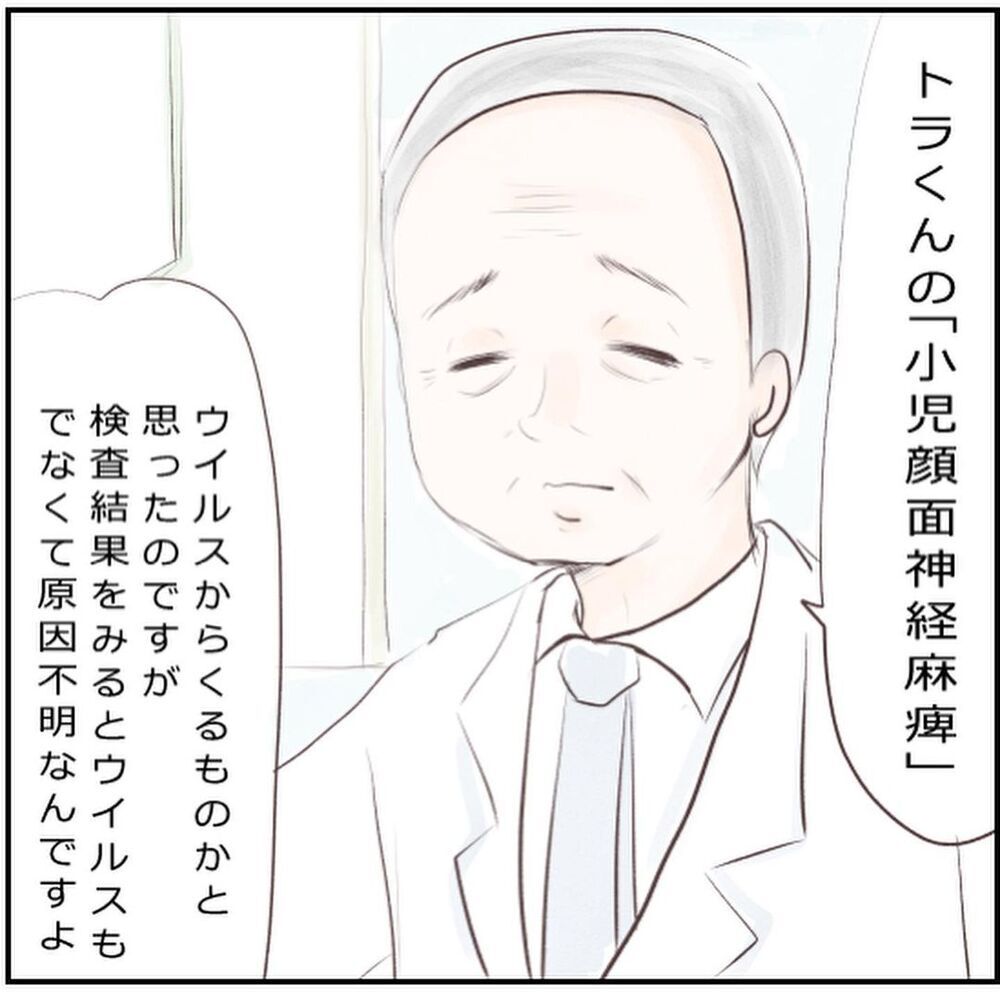 ウイルス感染もなし…息子が小児顔面麻痺になった理由とは？【生後3ヶ月の息子が小児顔面麻痺に Vol.10】