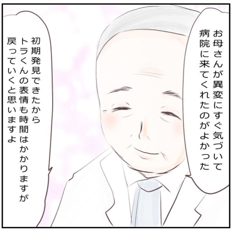 ウイルス感染もなし…息子が小児顔面麻痺になった理由とは？【生後3ヶ月の息子が小児顔面麻痺に Vol.10】