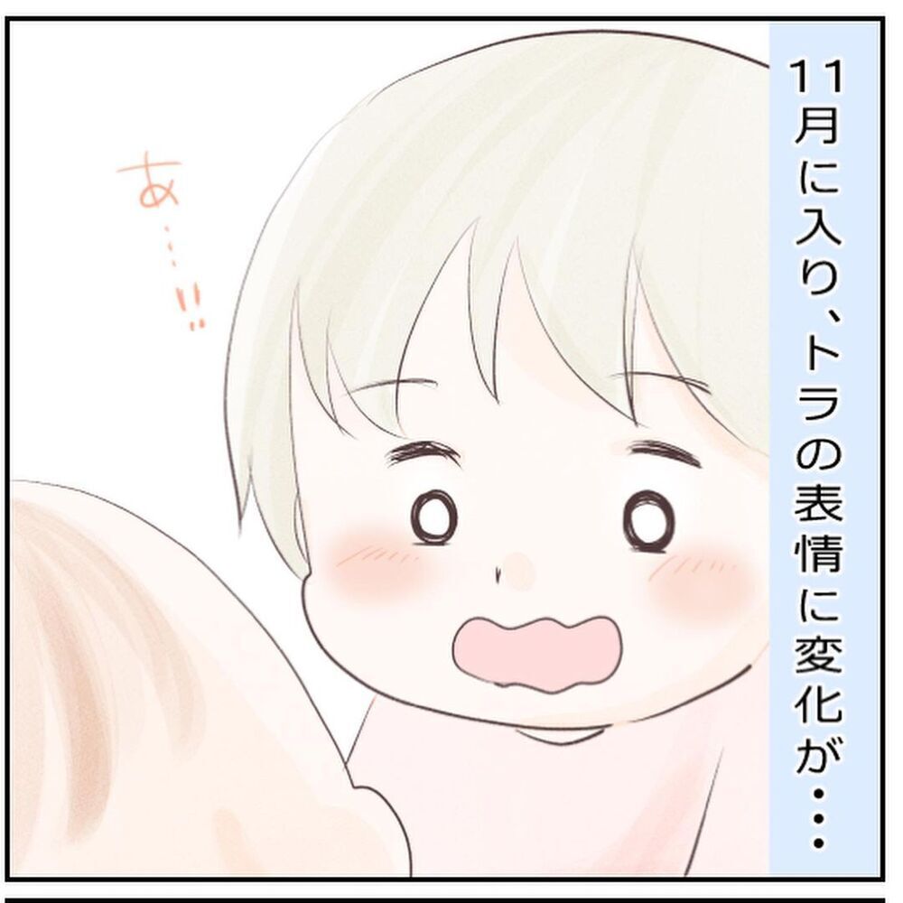 退院後もマッサージ＆目薬でケア…1歳半になった息子は今【生後3ヶ月の息子が小児顔面麻痺に Vol.11】