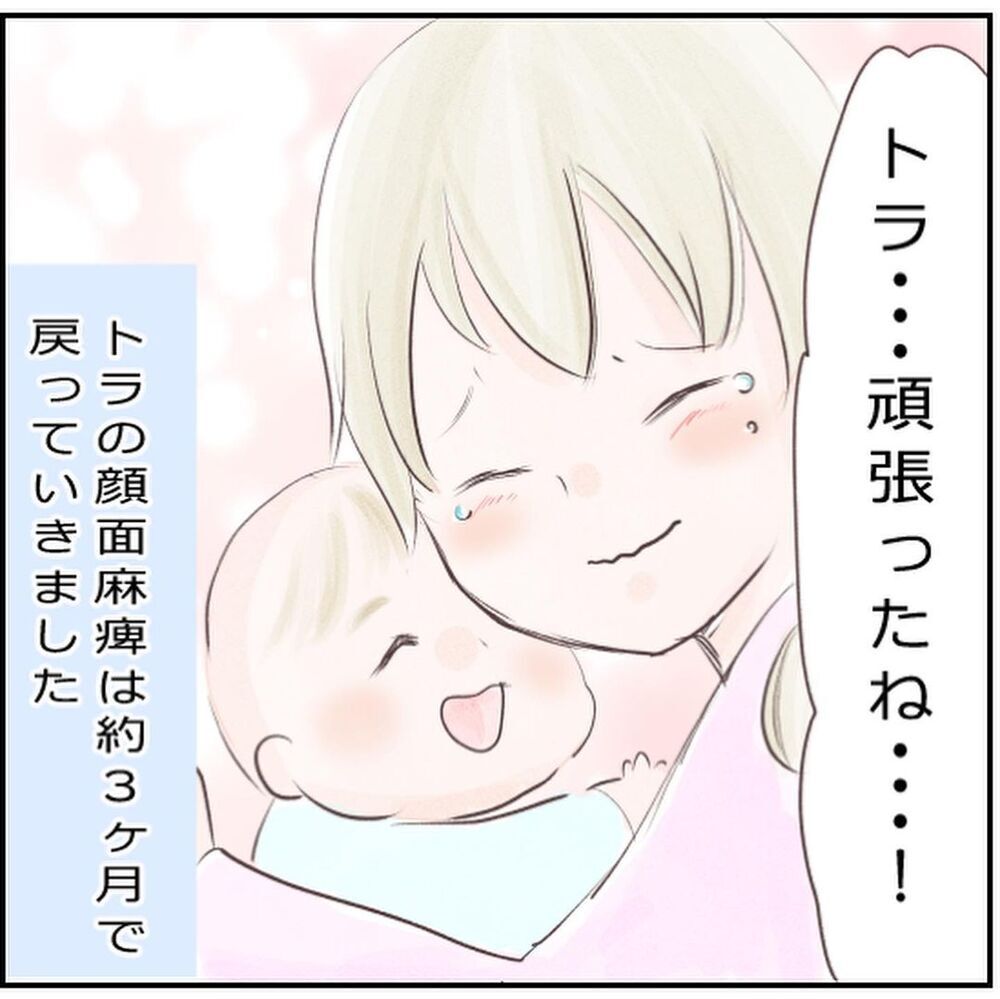 退院後もマッサージ＆目薬でケア…1歳半になった息子は今【生後3ヶ月の息子が小児顔面麻痺に Vol.11】