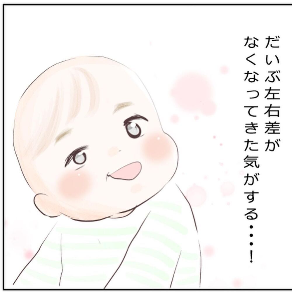 退院後もマッサージ＆目薬でケア…1歳半になった息子は今【生後3ヶ月の息子が小児顔面麻痺に Vol.11】