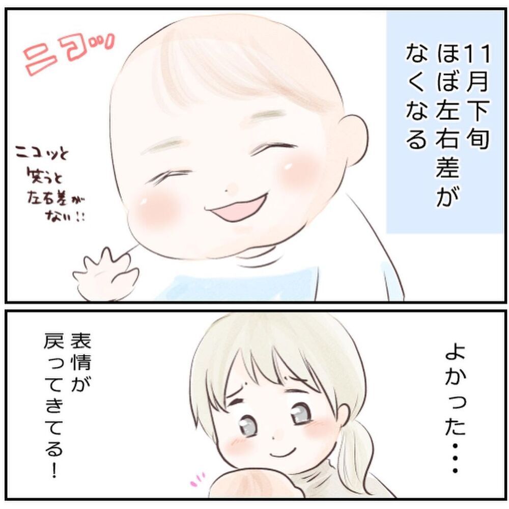 退院後もマッサージ＆目薬でケア…1歳半になった息子は今【生後3ヶ月の息子が小児顔面麻痺に Vol.11】