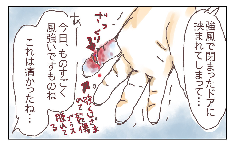 縫合か軟膏か!? 治療方法の選択に夫婦で動揺…！ ～息子が強風で閉まったドアに手を挟まれた話（2）～【シャトー家の観察絵日記 Vol.20】