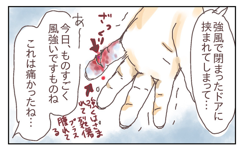 縫合か軟膏か!? 治療方法の選択に夫婦で動揺…！ ～息子が強風で閉まったドアに手を挟まれた話（2）～【シャトー家の観察絵日記 Vol.20】