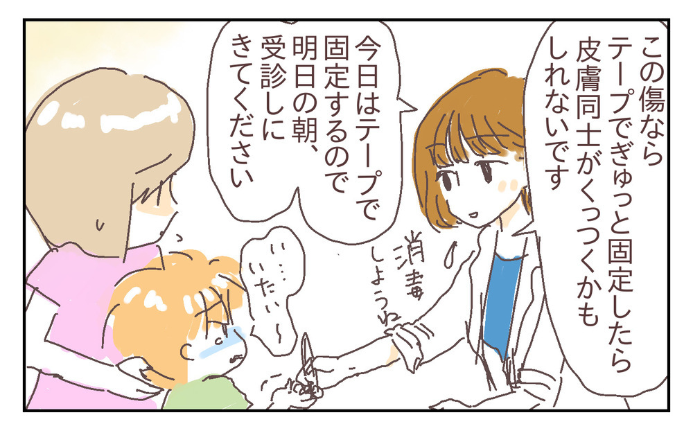 縫合か軟膏か!? 治療方法の選択に夫婦で動揺…！ ～息子が強風で閉まったドアに手を挟まれた話（2）～【シャトー家の観察絵日記 Vol.20】