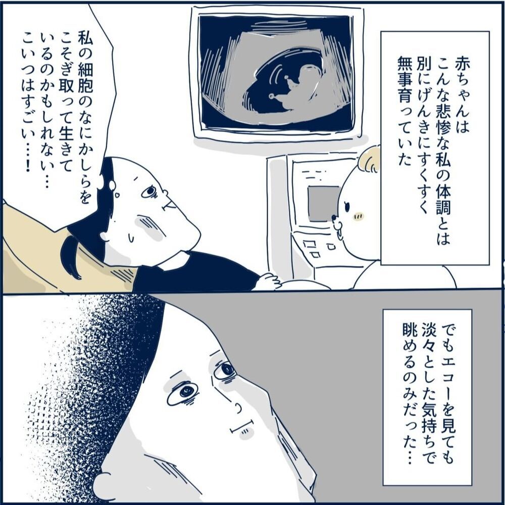 つわり中の車での長距離移動は耐えられるのか　妊婦健診の結果は…【重症妊娠悪阻になった時の話 Vol.12】