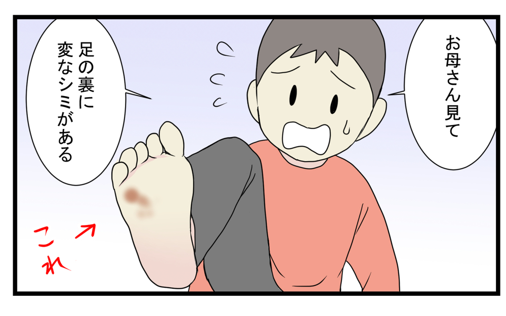 まさかのアノ虫が原因!? 長男の足の裏にできた「消えないシミ」【こどもと見つけた小さな発見日誌 Vol.45】