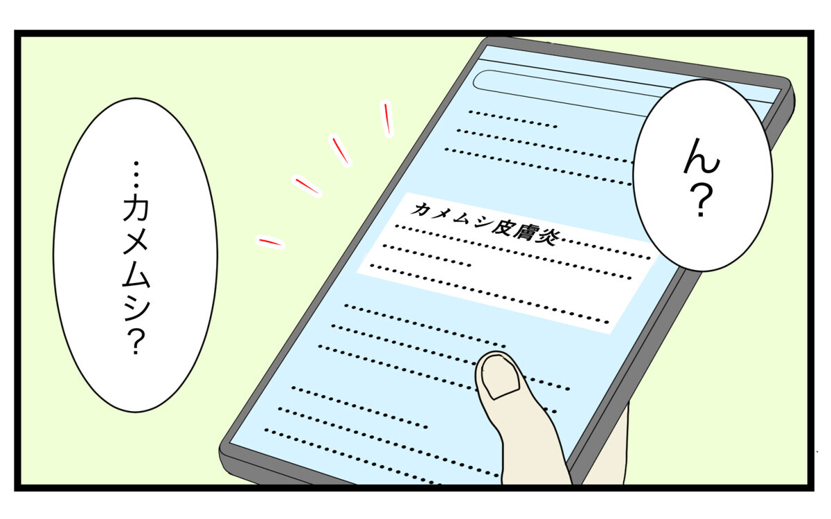 まさかのアノ虫が原因 長男の足の裏にできた 消えないシミ こどもと見つけた小さな発見日誌 Vol 45 ウーマンエキサイト 2 2