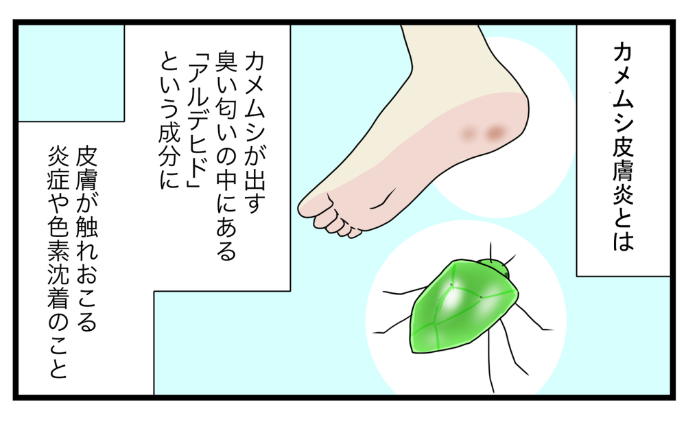 まさかのアノ虫が原因!? 長男の足の裏にできた「消えないシミ」【こどもと見つけた小さな発見日誌 Vol.45】