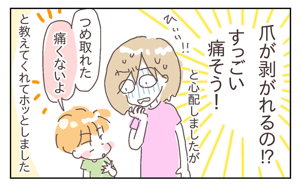 安全対策をしっかりと！ でも私がもう1つ心配なのは、夫の緊急時対応で… ～息子が強風で閉まったドアに手を挟まれた話（3）～【シャトー家の観察絵日記 Vol.21】