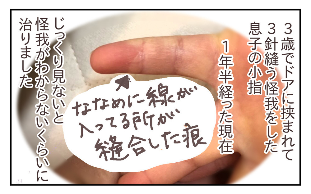 安全対策をしっかりと！ でも私がもう1つ心配なのは、夫の緊急時対応で… ～息子が強風で閉まったドアに手を挟まれた話（3）～【シャトー家の観察絵日記 Vol.21】