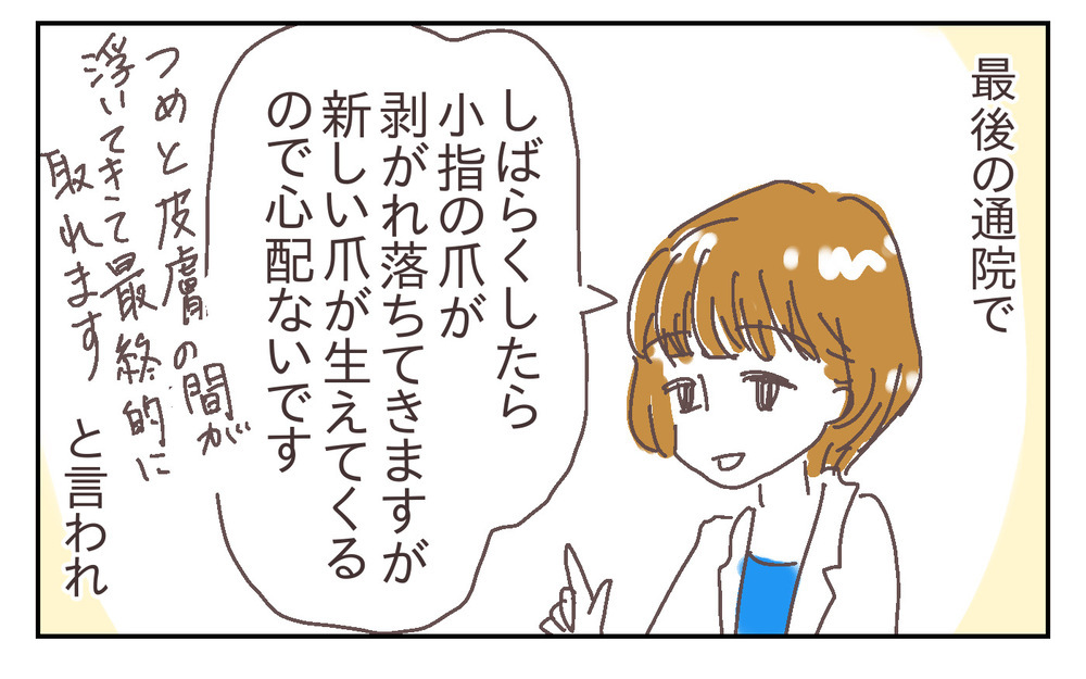 安全対策をしっかりと！ でも私がもう1つ心配なのは、夫の緊急時対応で… ～息子が強風で閉まったドアに手を挟まれた話（3）～【シャトー家の観察絵日記 Vol.21】