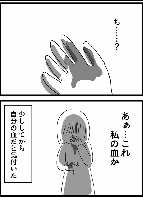 いったい何が起こったの…？ 反論直後に妻が受けた、夫からの仕打ち【優しかった夫の裏の顔  Vol.21】