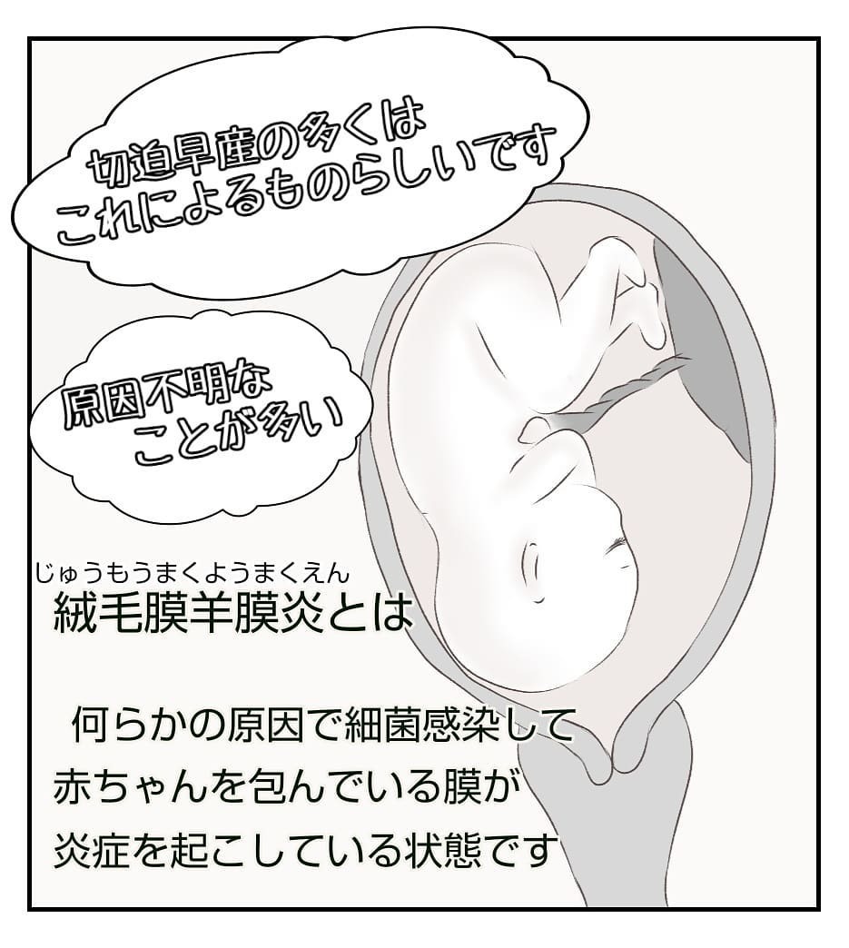 切迫早産で急遽入院!? 病室に案内されるとそこには…【切迫早産で入院中に同室の人が辛かった話 Vol.2】