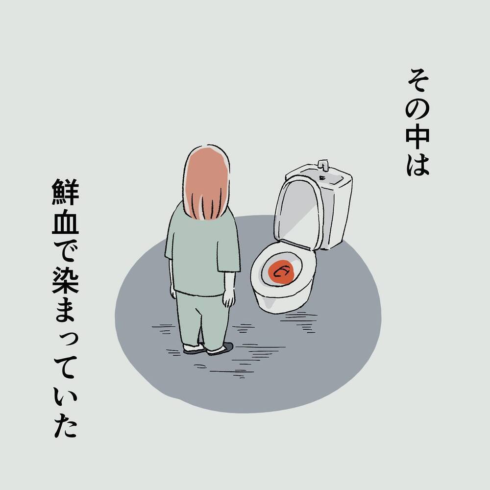 予定日を過ぎてようやく破水！ 出産に備え浣腸をしたら異変が!?【"痔"獄の出産レポート Vol.1】