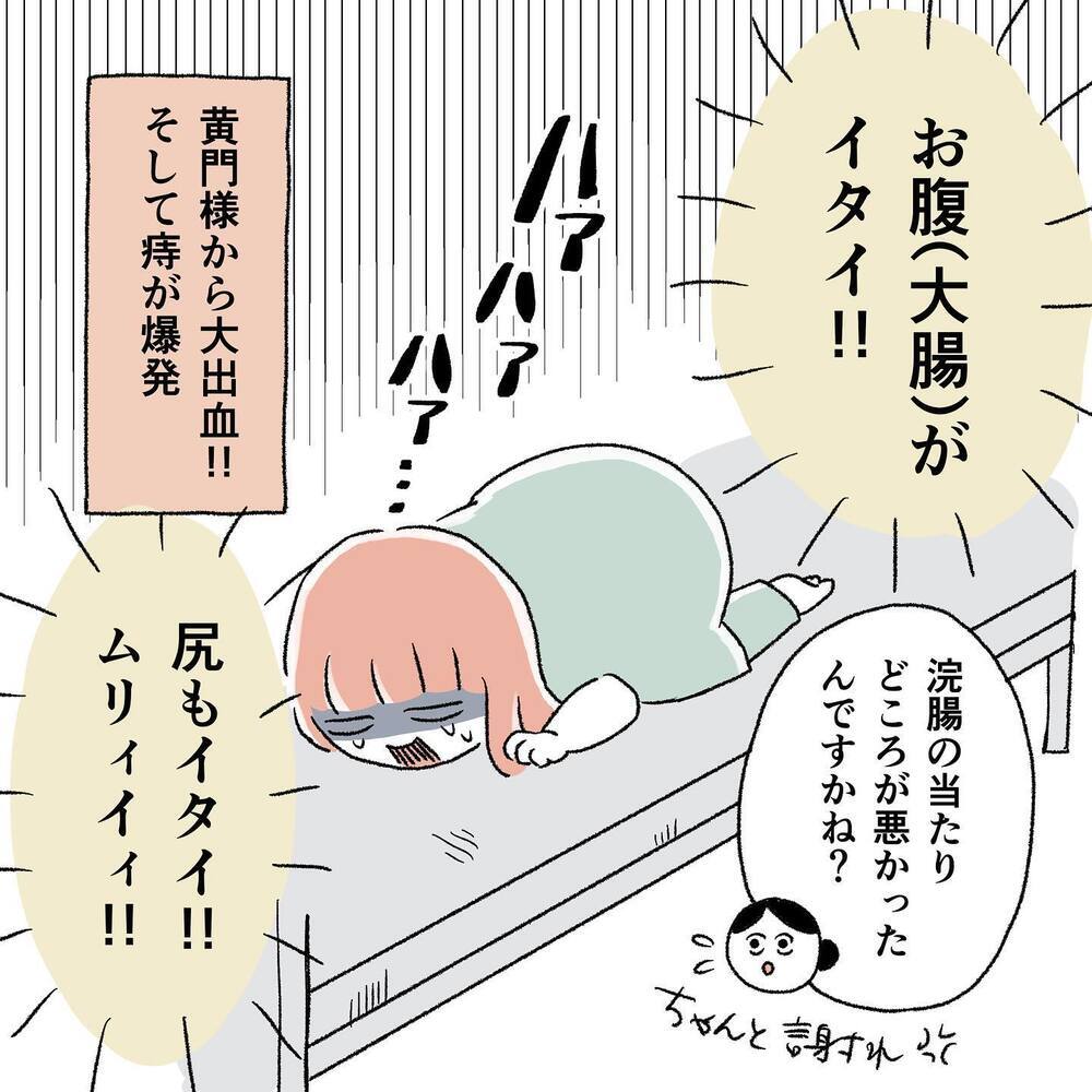 痔の爆発でお尻が激痛…！ 陣痛どころじゃない【"痔"獄の出産レポート Vol.2】