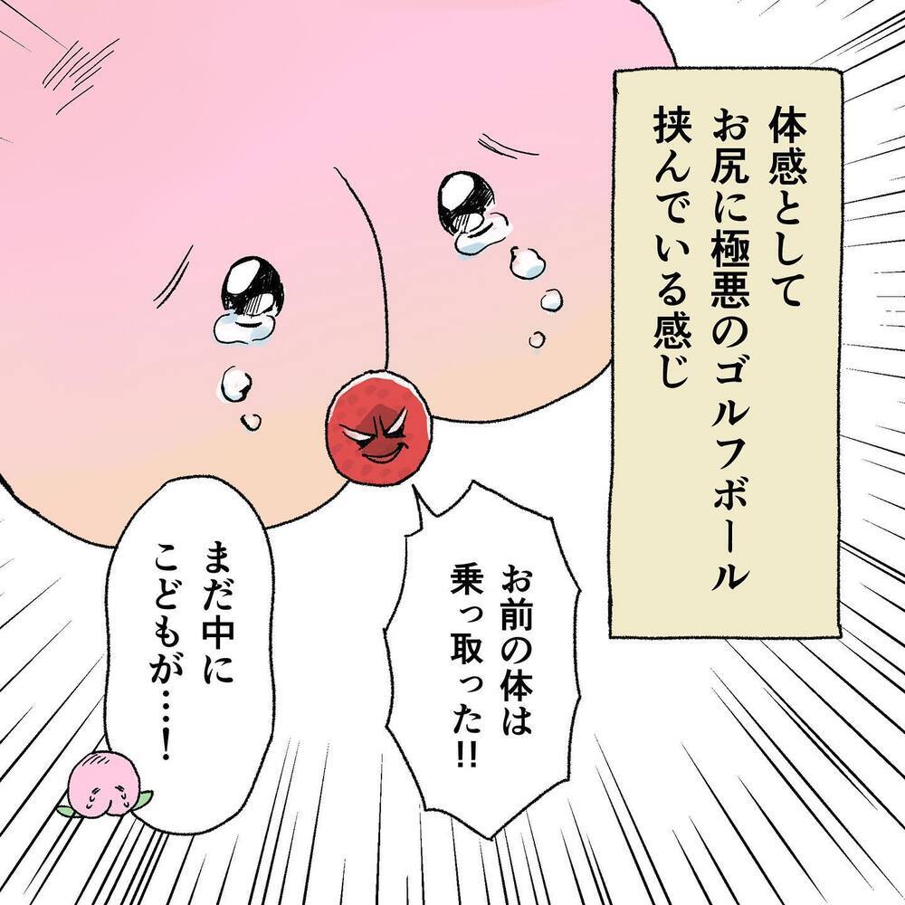 痔の爆発でお尻が激痛…！ 陣痛どころじゃない【"痔"獄の出産レポート Vol.2】