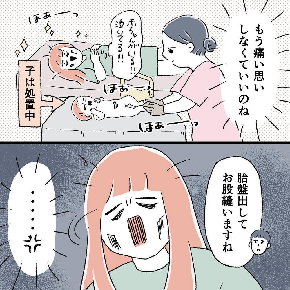 いつの間にか生まれてた！ でも、これで痛みから解放される!?【"痔"獄の出産レポート Vol.6】