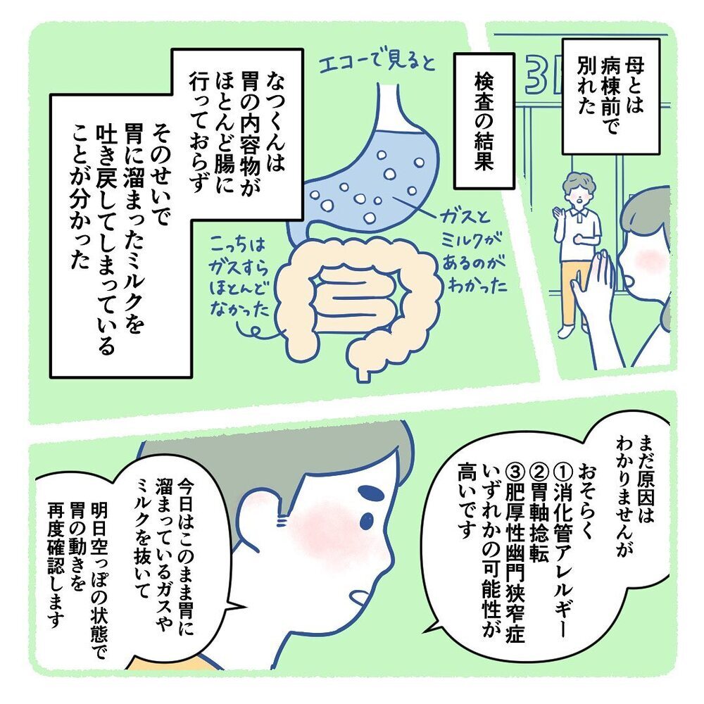 生後3週間の息子が何度も吐き戻してしまう… 医師に言われた3つの可能性【生後3週間で手術しました Vol.2】