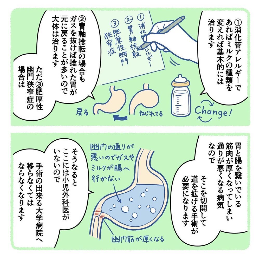 生後3週間の息子が何度も吐き戻してしまう… 医師に言われた3つの可能性【生後3週間で手術しました Vol.2】