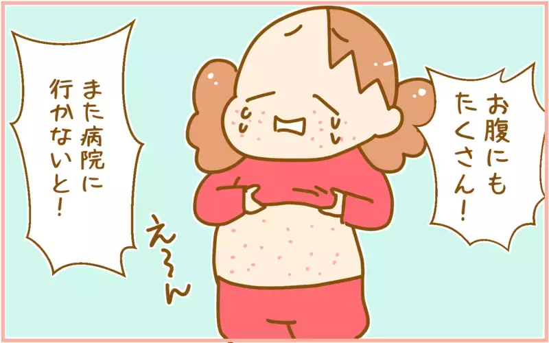 赤ちゃんの頃だけじゃない!?  娘が4歳で「突発性発疹」になった話【ふたごむすめっこ×すえむすめっこ 第92話】