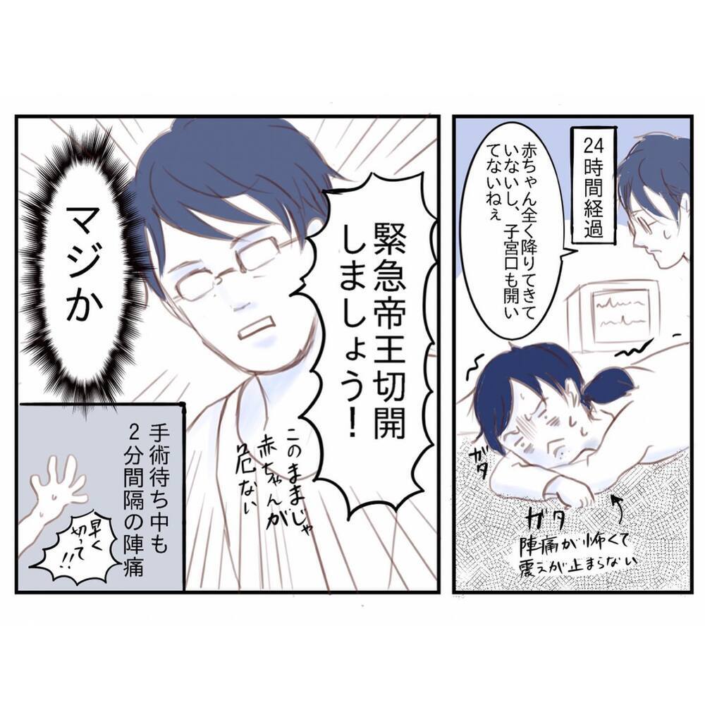 陣痛25時間からの帝王切開で出産！ 初めて触れた娘に感じた違和感【娘と心疾患のお話 Vol.2】