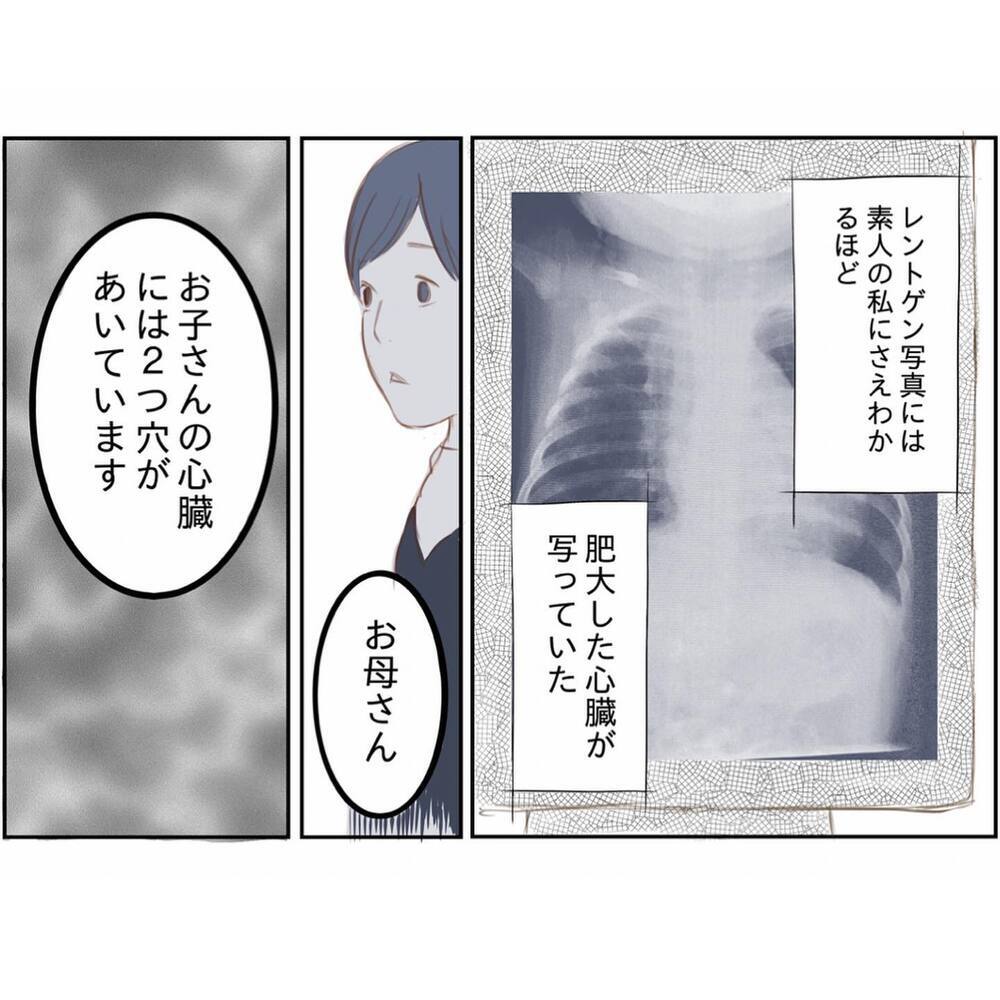 娘の病気が明らかに…原因がわかり、不安だった日々に希望の光が？【娘と心疾患のお話 Vol.5】