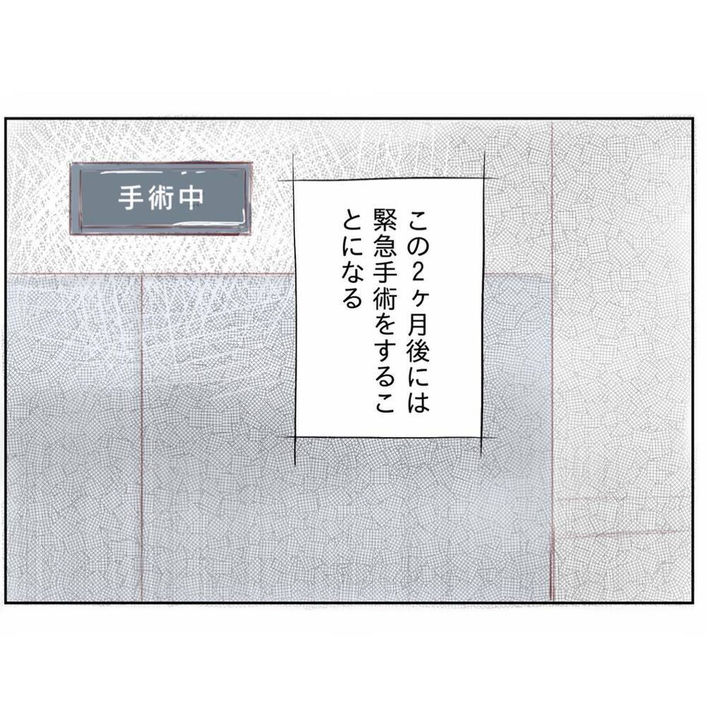 手術は生後6ヶ月の頃に　ようやく治療の見通しができたと思っていたけれど…【娘と心疾患のお話 Vol.7】