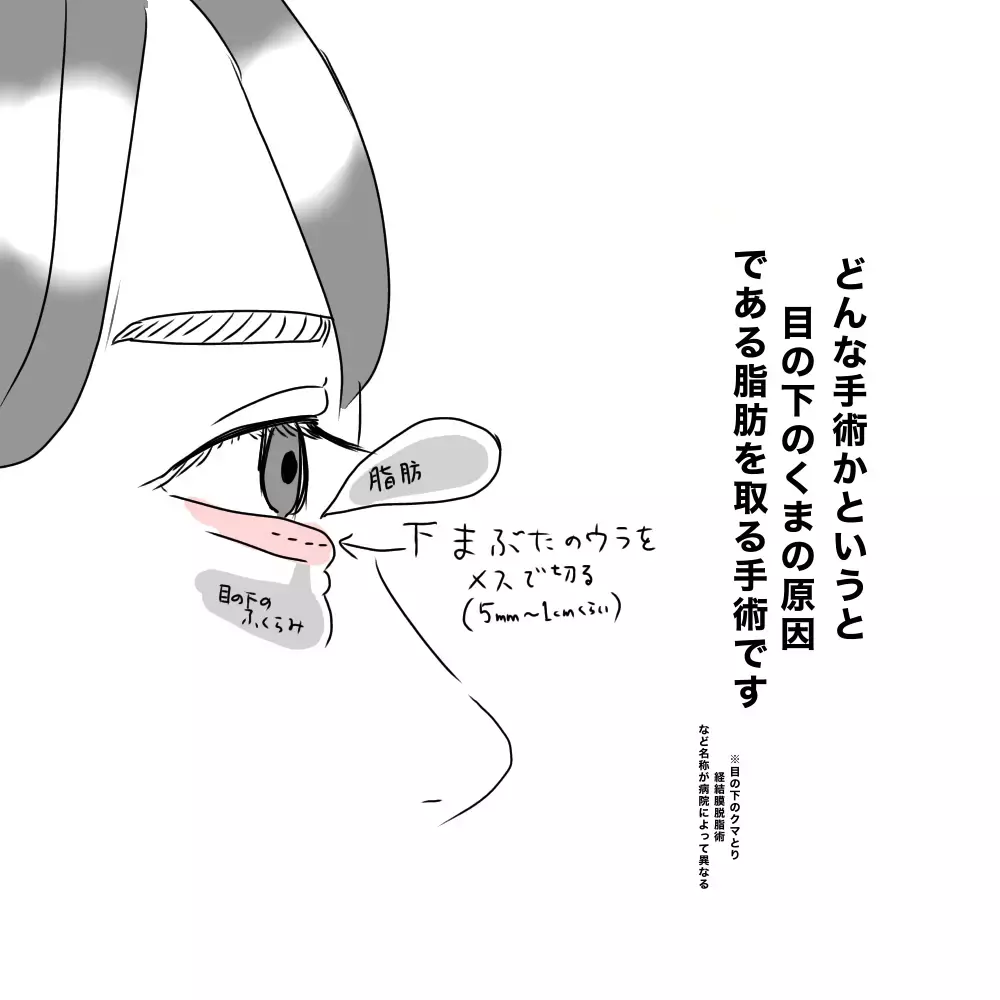「顔色悪いね」クマがあると心配されてしまう…私が美容整形した理由【夫に内緒で整形した話 Vol.1】