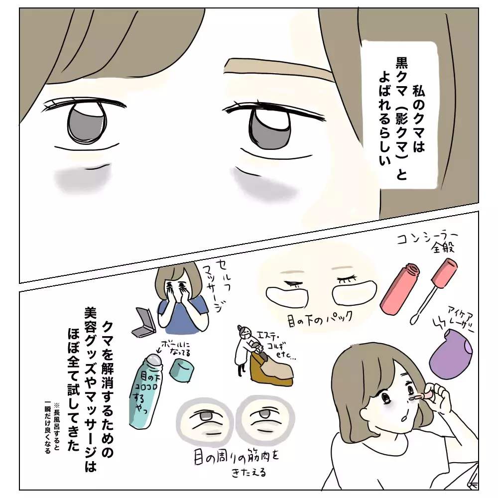 「顔色悪いね」クマがあると心配されてしまう…私が美容整形した理由【夫に内緒で整形した話 Vol.1】