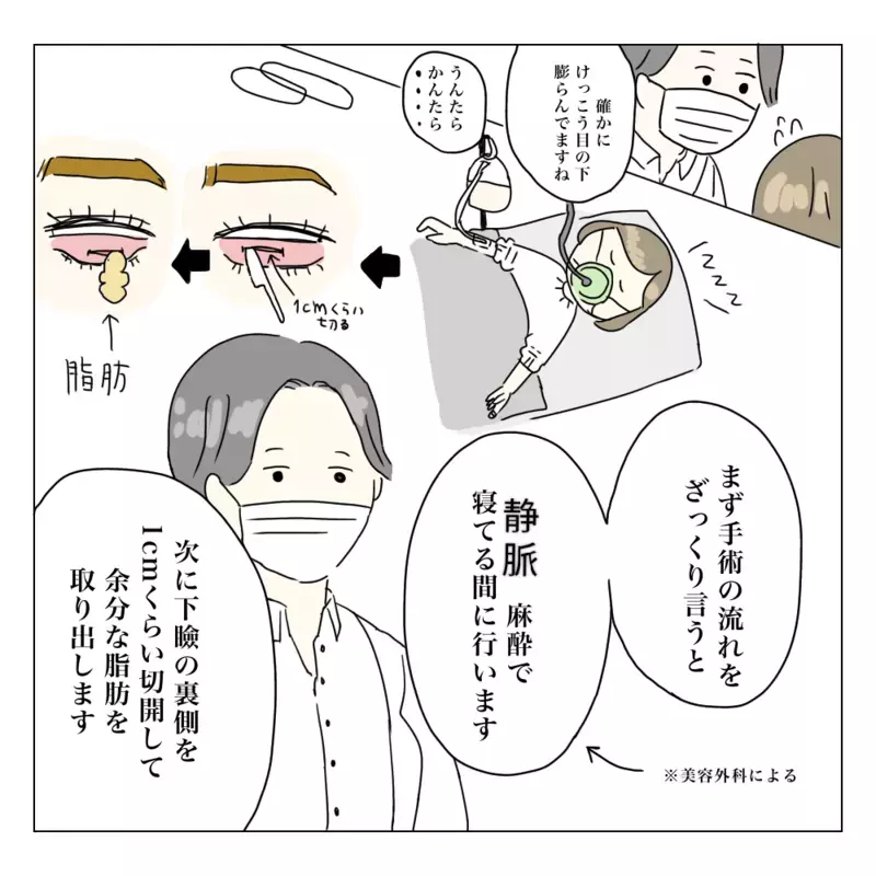 費用は？ 術後の腫れは？ 家族にも嘘をついたからもう後戻りできない！　【夫に内緒で整形した話 Vol.3】