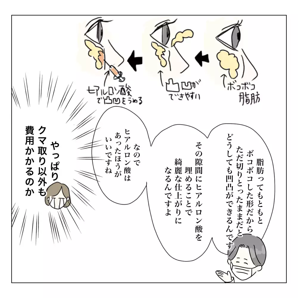 費用は？ 術後の腫れは？ 家族にも嘘をついたからもう後戻りできない！　【夫に内緒で整形した話 Vol.3】