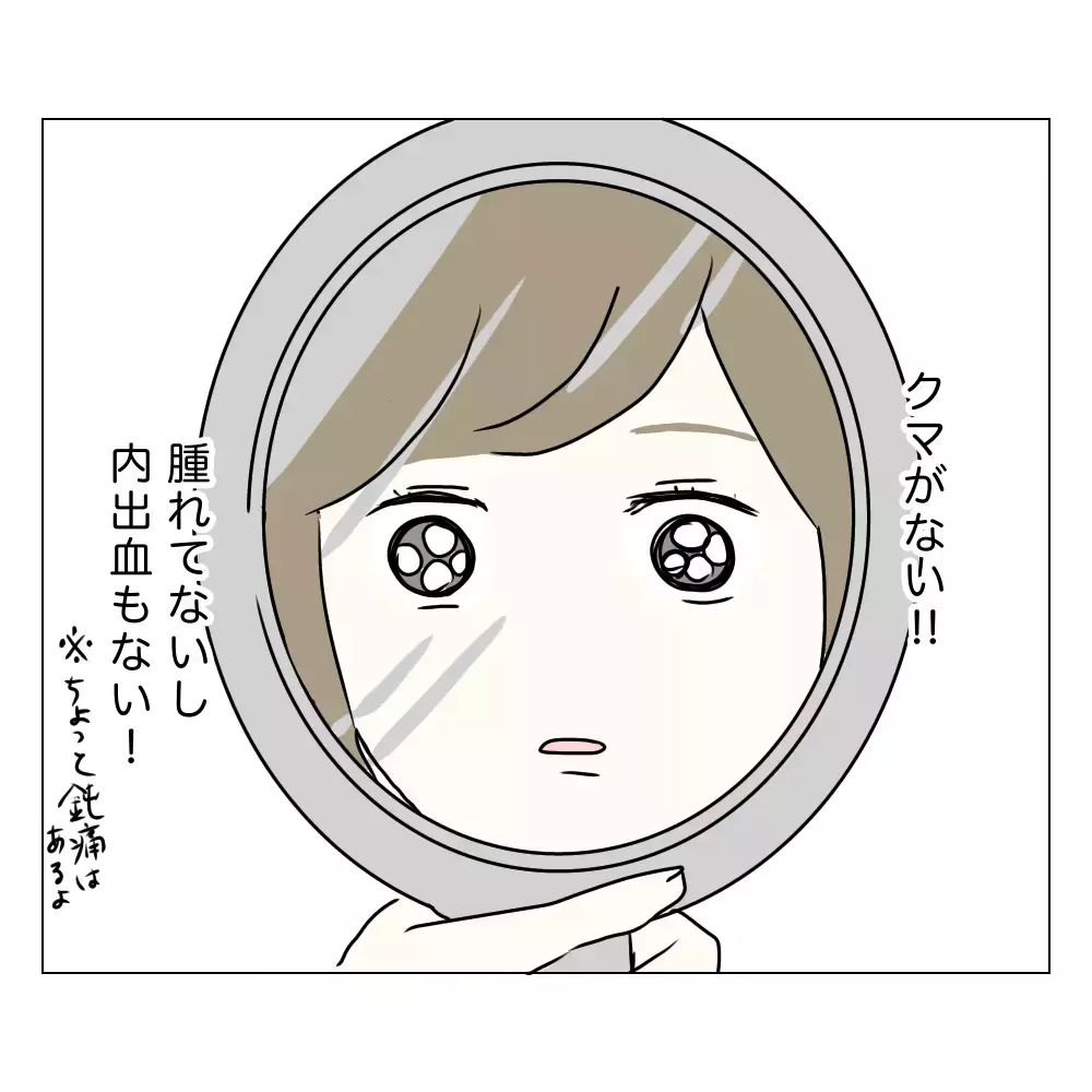 手術後の顔を鏡で確認すると…？ 私の目元はどうなったの!?【夫に内緒で整形した話 Vol.8】