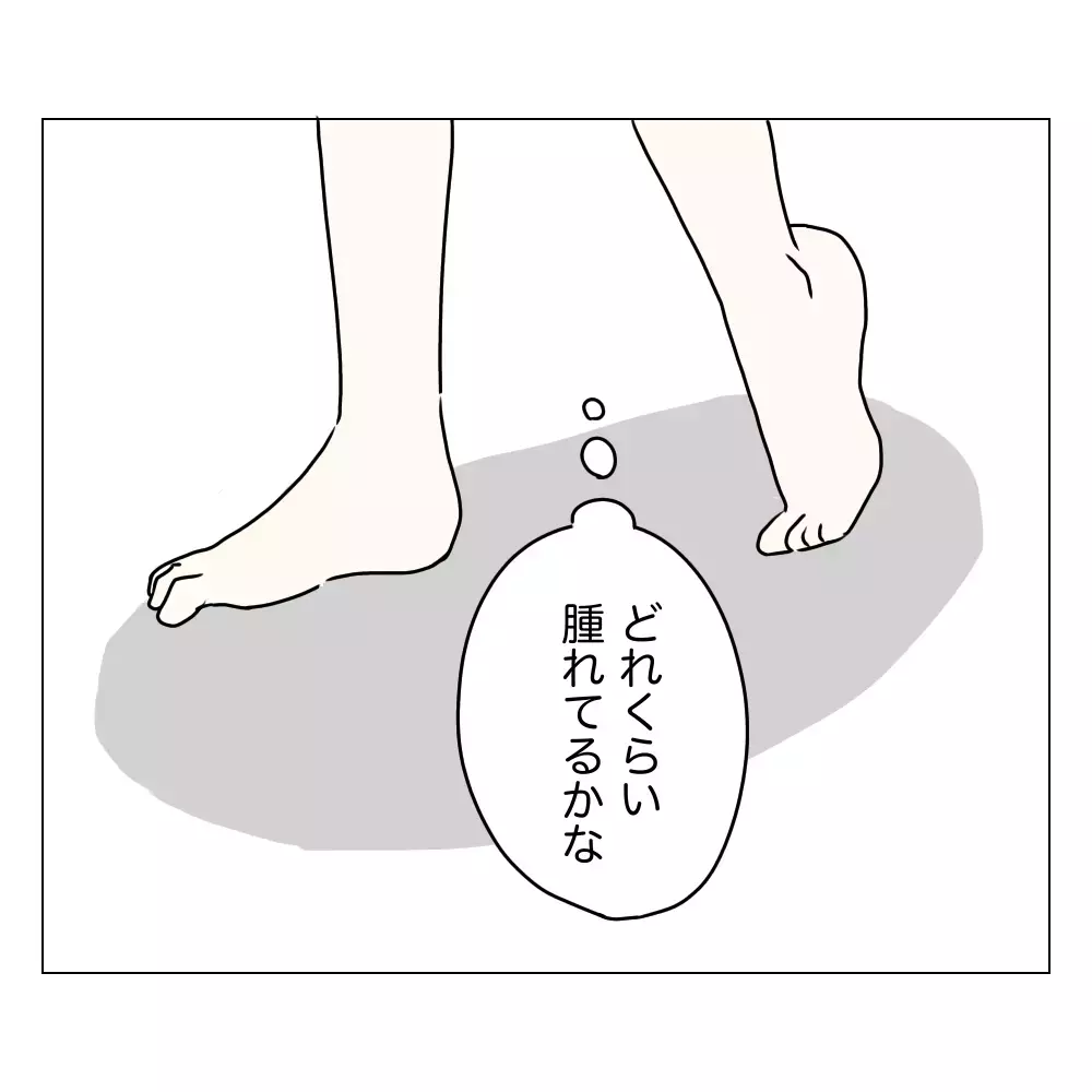 手術の翌日はやっぱり違和感ある!? 夫には隠し通せるのか…！【夫に内緒で整形した話 Vol.10】