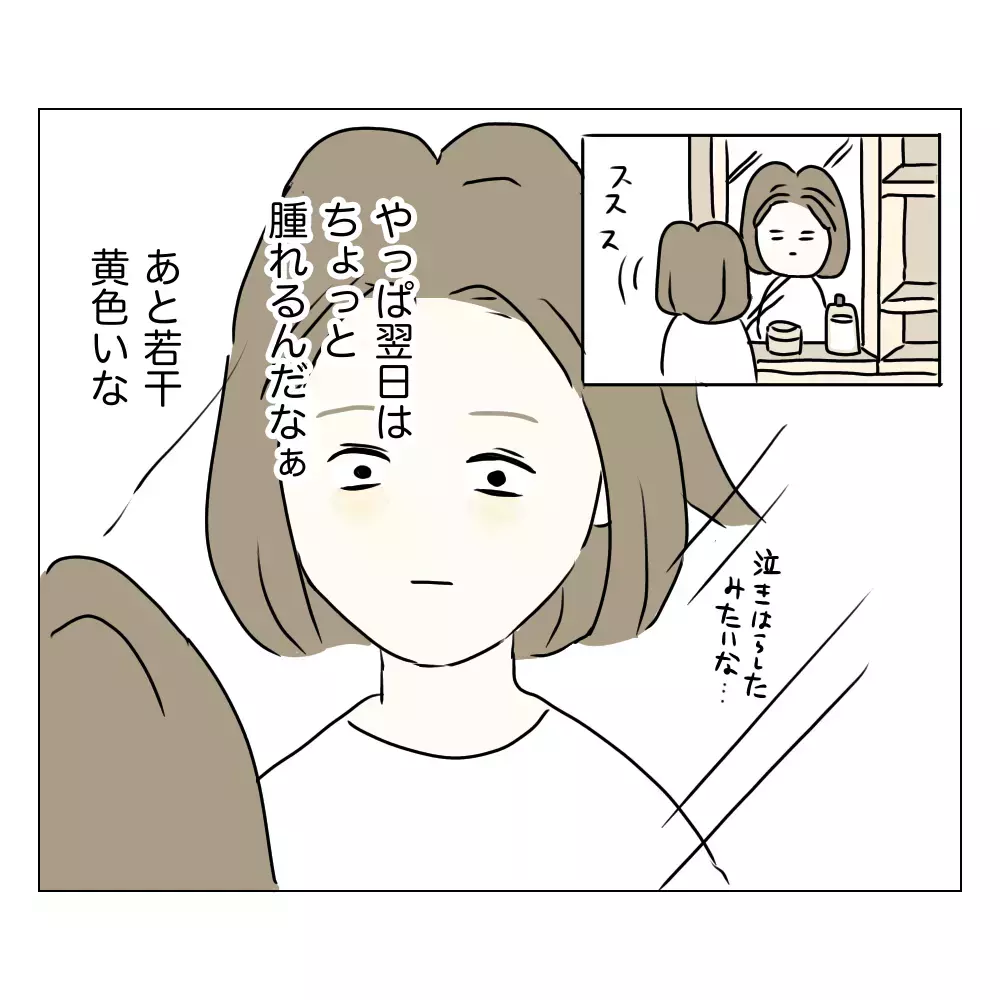 手術の翌日はやっぱり違和感ある!? 夫には隠し通せるのか…！【夫に内緒で整形した話 Vol.10】