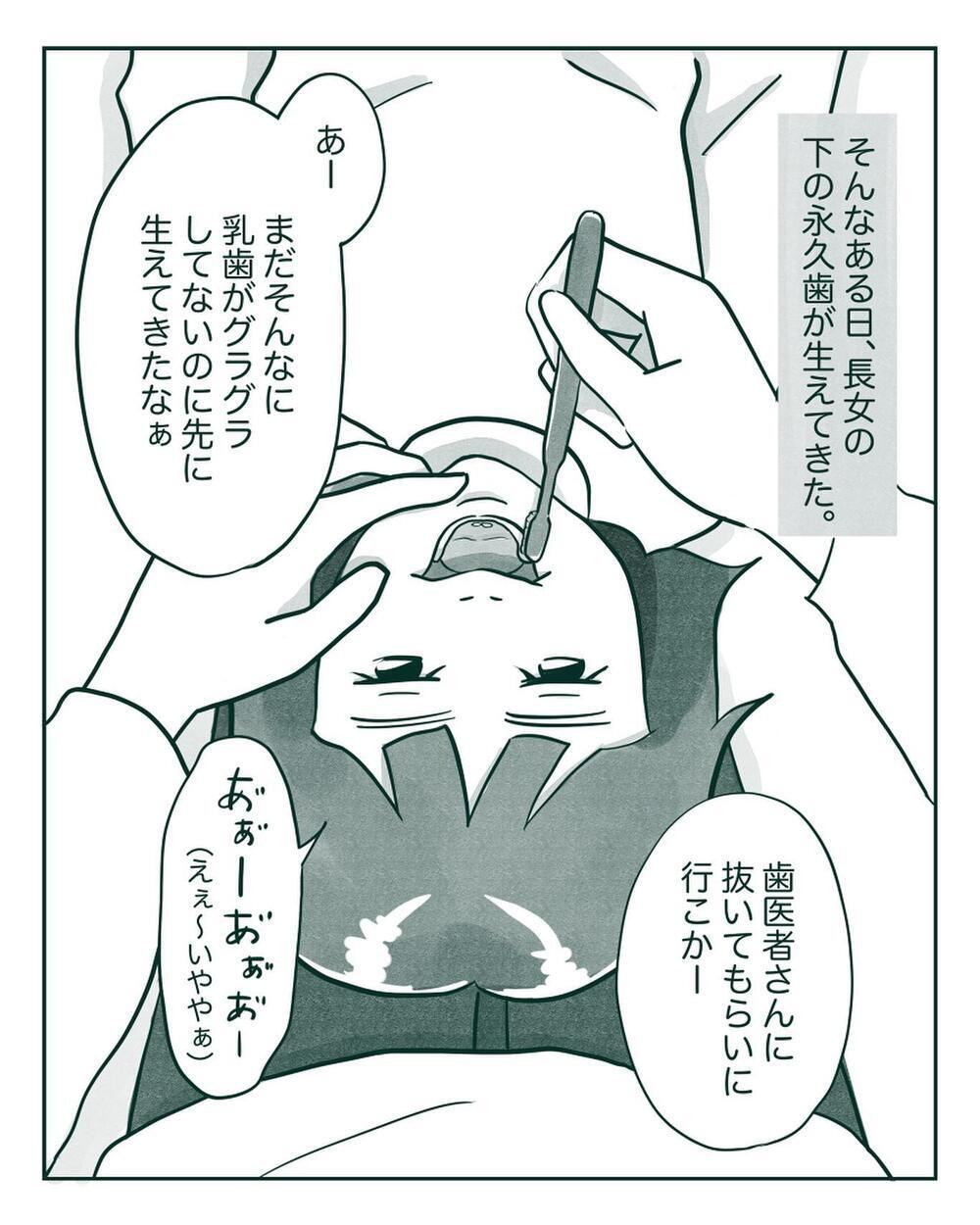 反抗心も抜けた!? 抜歯をキッカケに長女に劇的な変化が表れる【中間反抗期の5歳がいます Vol.11】