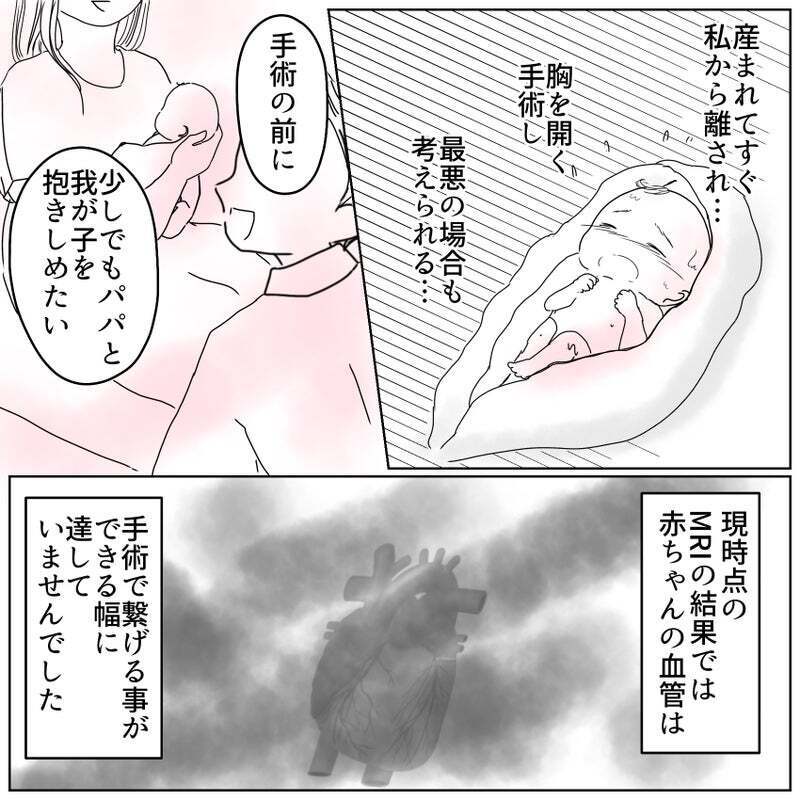 手術前、少しでも我が子を抱きしめたい…夫婦の想いに病院は？【天使が生きる奇跡 Vol.19】