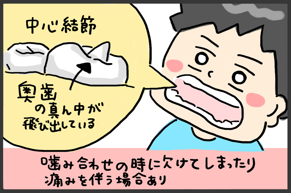 1歳なのに毛も歯も生えてこない…！　心配しすぎた当時の私に言いたいこと【メンズかーちゃん～うちのやんちゃで愛おしいおさるさんの物語～ 第121回】