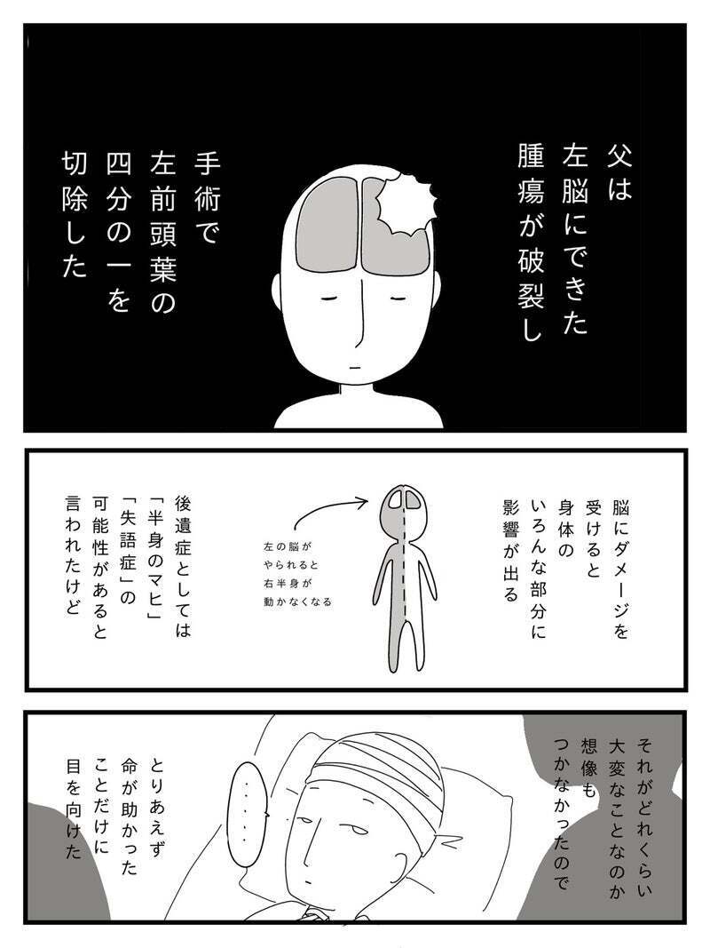 手術で前頭葉を切除　その後父におとずれた恐るべき後遺症とは？【若年性認知症の父親と私 Vol.4】