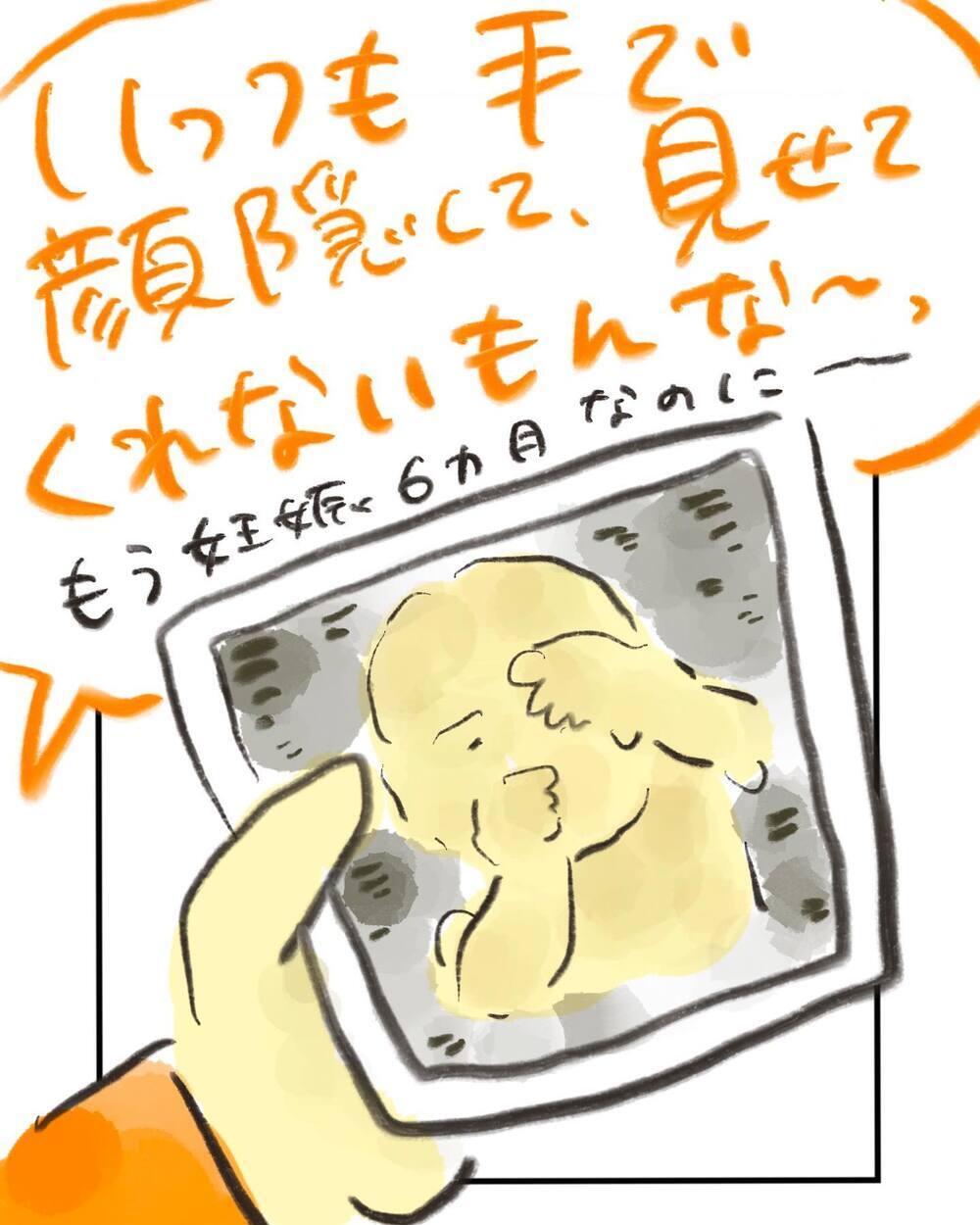 お腹の子は恥ずかしがり屋？ 「今日こそお顔が見たい」エコー検査に期待する夫婦【どうして私のおくちは割れてるの？ Vol.1】