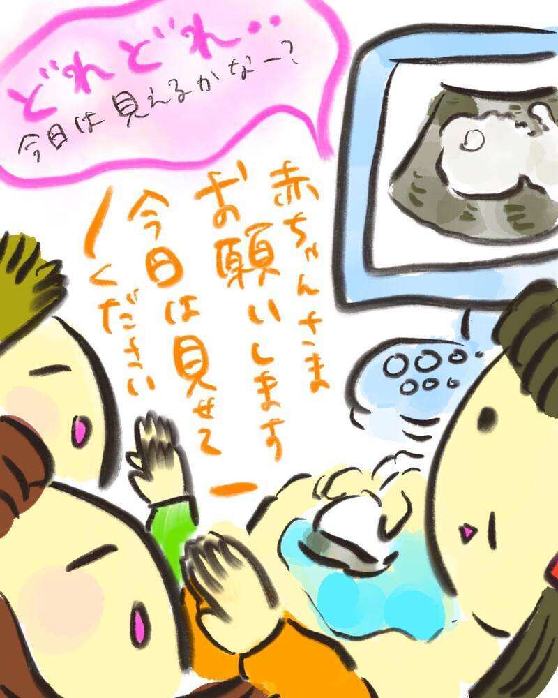 エコー検査をした医師の表情に動揺が…いったい何があったの？【どうして私のおくちは割れてるの？ Vol.2】