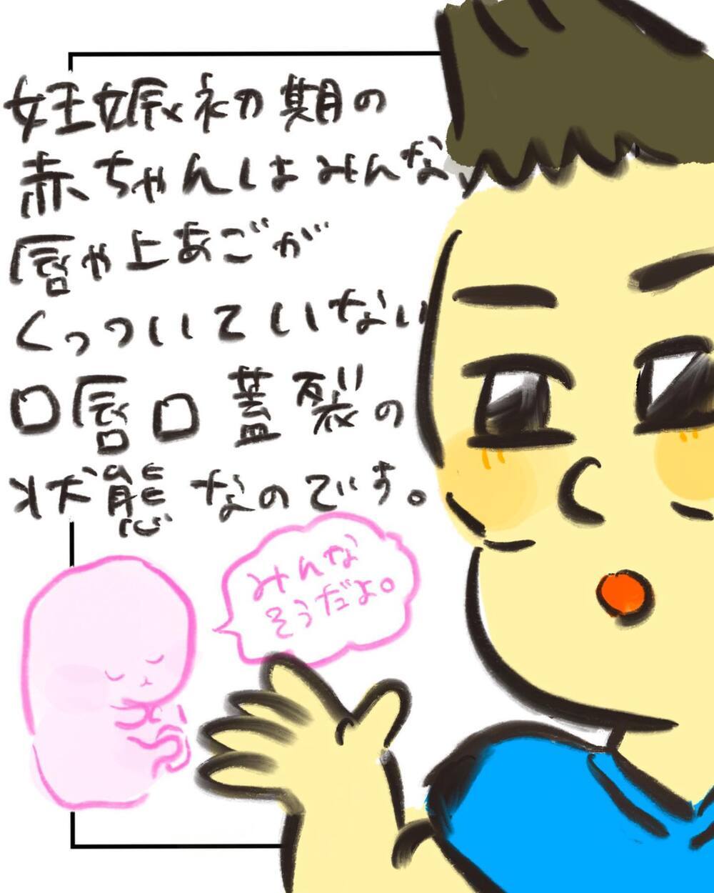 500人に1人の割合!? 医師の説明は驚きの連続で…！【どうして私のおくちは割れてるの？ Vol.7】