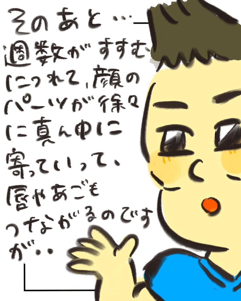 500人に1人の割合!? 医師の説明は驚きの連続で…！【どうして私のおくちは割れてるの？ Vol.7】