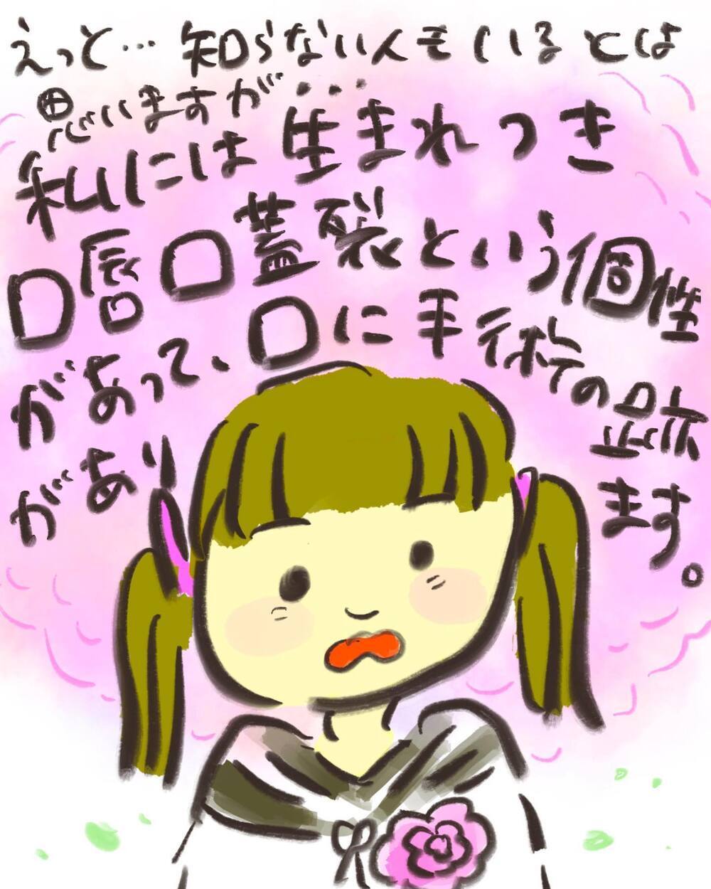 「口唇口蓋裂のコンプレックスのおかげで…」私が伝えたかったこと【どうして私のおくちは割れてるの？ Vol.30】