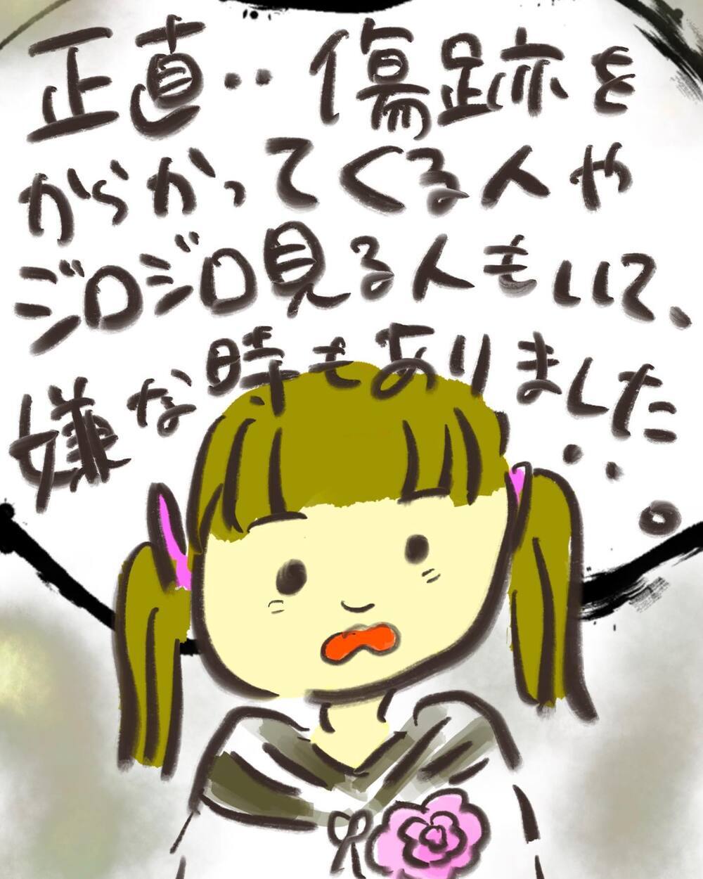 「嫌だな」が「悪くない」に変わる…人生って面白い【どうして私のおくちは割れてるの？ Vol.31】