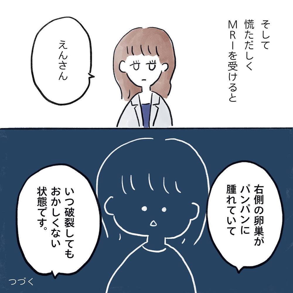 生理痛に救世主現る！ 劇的に改善するが、定期診察で問題が…!?【生理痛・卵巣嚢腫破裂がしんどすぎて出産が〇〇だった話 Vol.2】