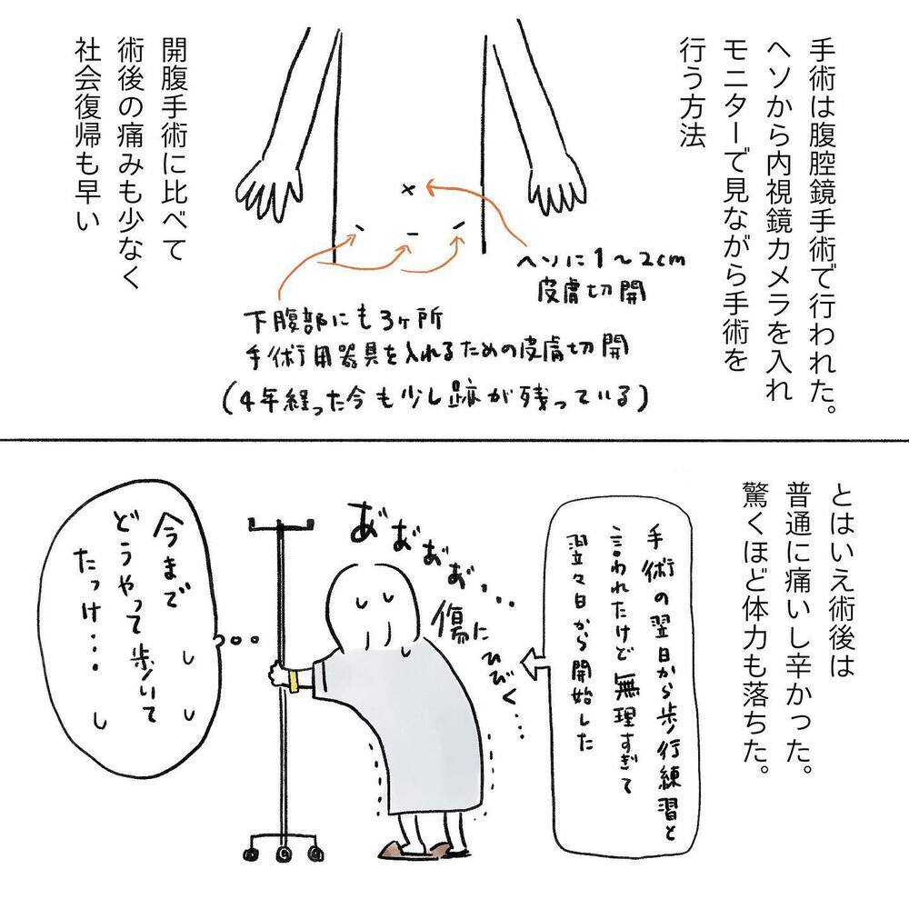 再発の可能性がある…!? 終わりの見えない治療に不安が募る【生理痛・卵巣嚢腫破裂がしんどすぎて出産が〇〇だった話 Vol.6】