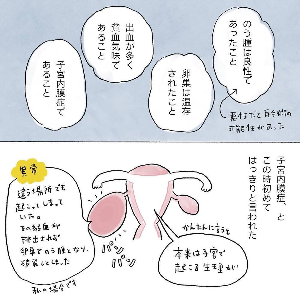 再発の可能性がある…!? 終わりの見えない治療に不安が募る【生理痛・卵巣嚢腫破裂がしんどすぎて出産が〇〇だった話 Vol.6】