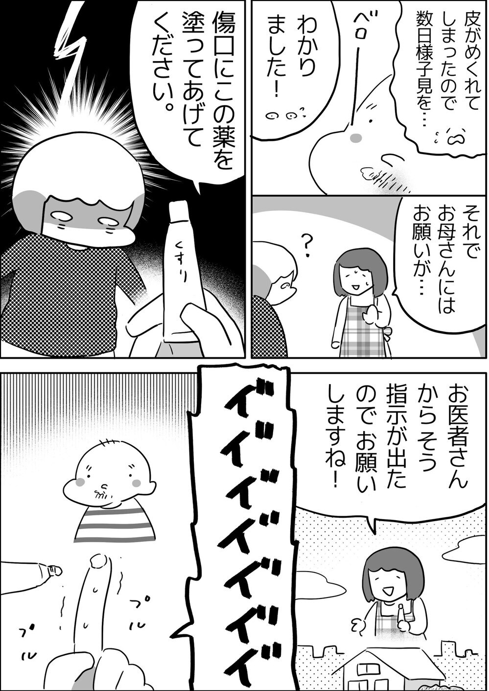 修羅場なのはいったい誰!? 長男が保育園で顔にケガをして…【やっぱり家が好き〜おっとぅんとみったんと私〜 第109話】